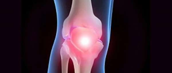 Диагностика и лечение эпикондилита коленного сустава